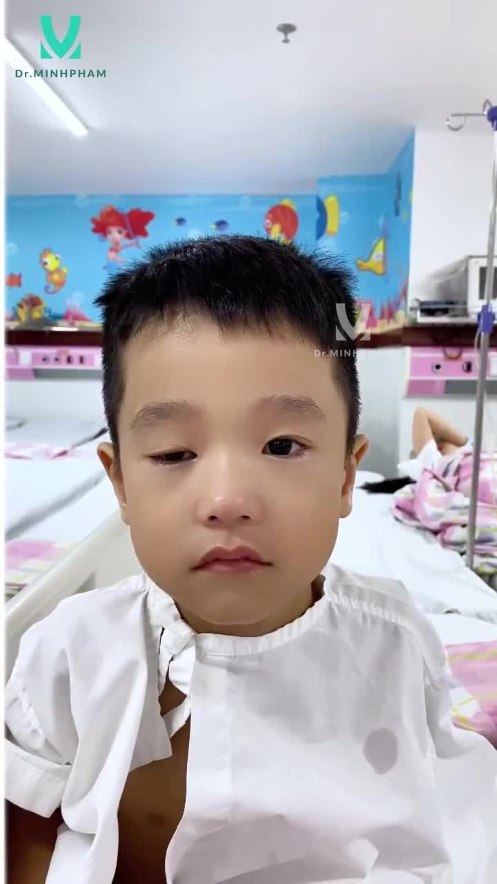 HÀNH TRÌNH PHẪU THUẬT SỤP MI THÀNH CÔNG – BÉ HẢI DUY
