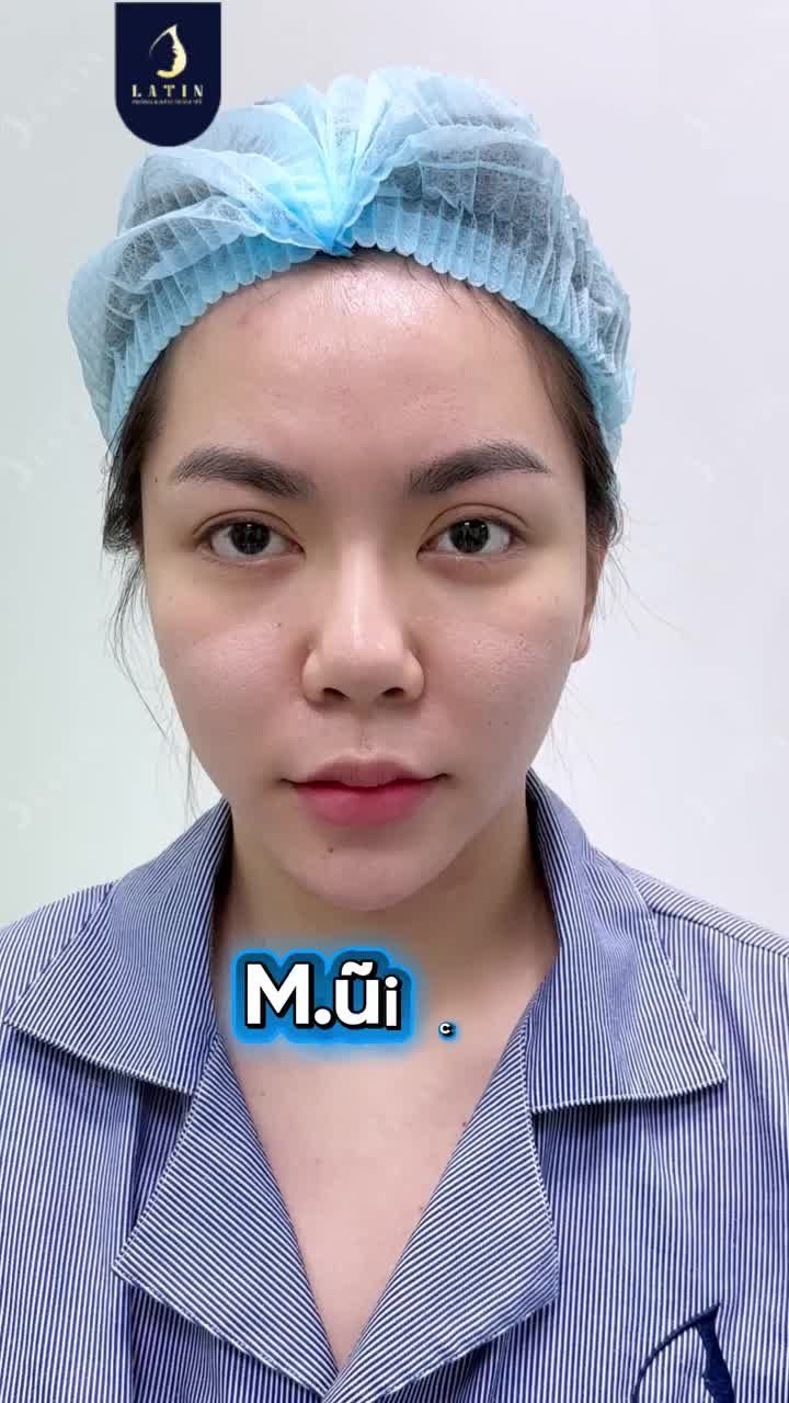 GẦN 20 SỢI CHỈ NẰM TRONG MŨI SUỐT 6 THÁNG?