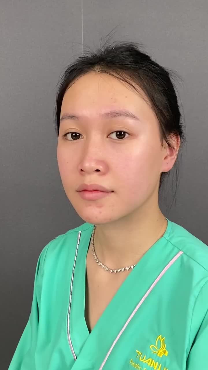 Dáng mũi hài hòa tự nhiên, phù hợp đường nét gương mặt giúp bạn xinh đẹp, thanh tú hơn.