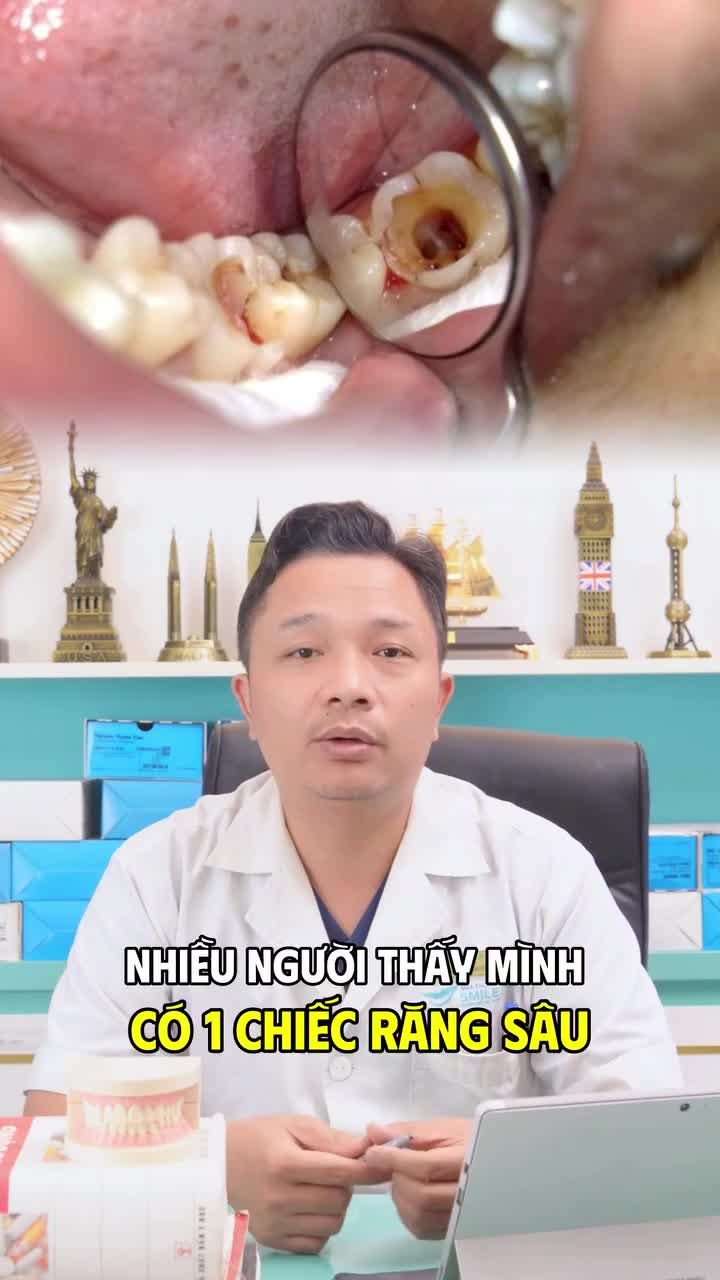 Răng sâu to mà không đau, coi chừng mất luôn cả hàm răng! Xem ngay cảnh báo của ThS. BS Nguyễn Tuấn Dương để phòng ngừa nhé!