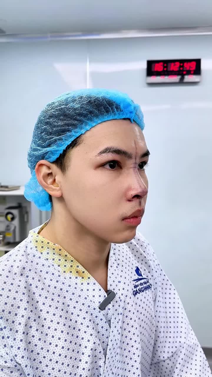 HOT BOY SÀI GÒN CHIA SẺ TRẢI NGHIỆM NÂNG MŨI SURGIFORM TẠI BỆNH VIỆN THẨM MỸ GANGWHOO