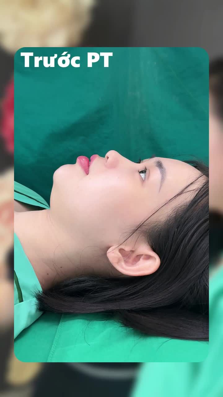 DÁNG MŨI TRUNG HOA – THANH TÚ, SANG TRỌNG, CHUẨN GU Á ĐÔNG