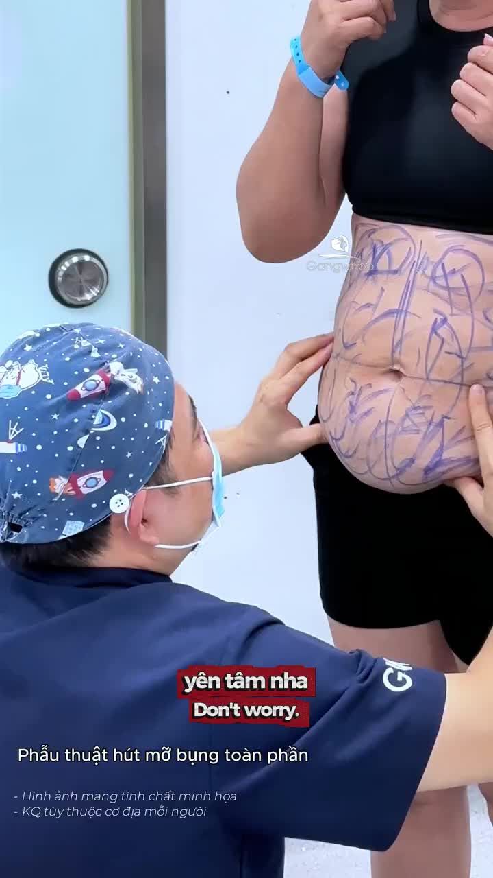 Theo dõi Bác sĩ suốt nhiều năm, sau thời gian tích góp, hôm nay mới tự tin đến giảm mỡ bụng và chỉ sau 60 phút phẫu thuật, chị khách về dáng nhẹ nhàng
