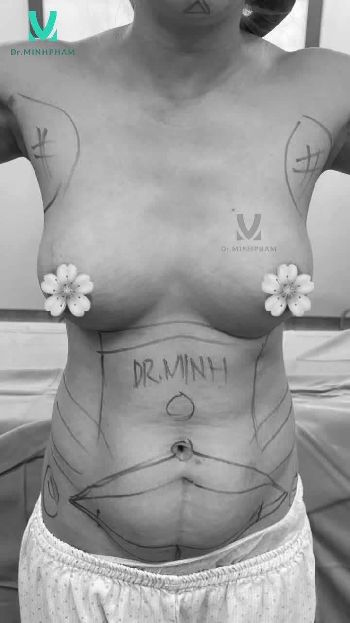 Độ Body đón tết cùng Dr. Minh Phạm, thời điểm vàng để chị em tân trang sắc vóc đón năm mới!