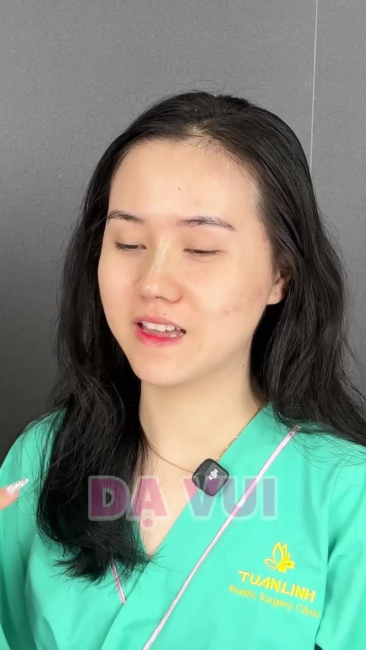 NÂNG MŨI BỌC SỤN - GIÁ CHỈ 17TR - ĐẸP XUẤT SẮC!!
