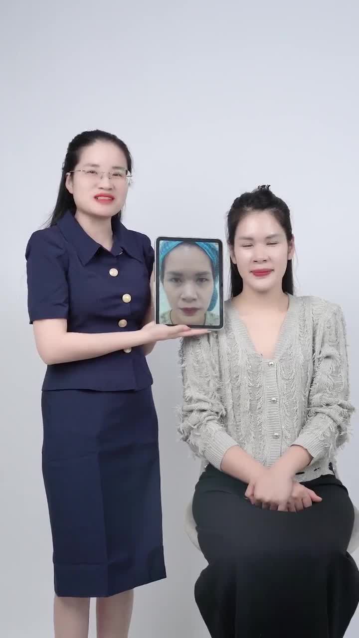 MÍ MẮT ĐẸP TỰ NHIÊN SAU 3 THÁNG CẮT MÍ