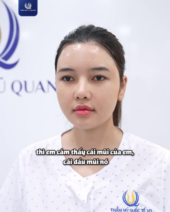 2 NĂM SỐNG CHUNG VỚI CHIẾC MŨI HỎNG....VÀ CÁI KẾT