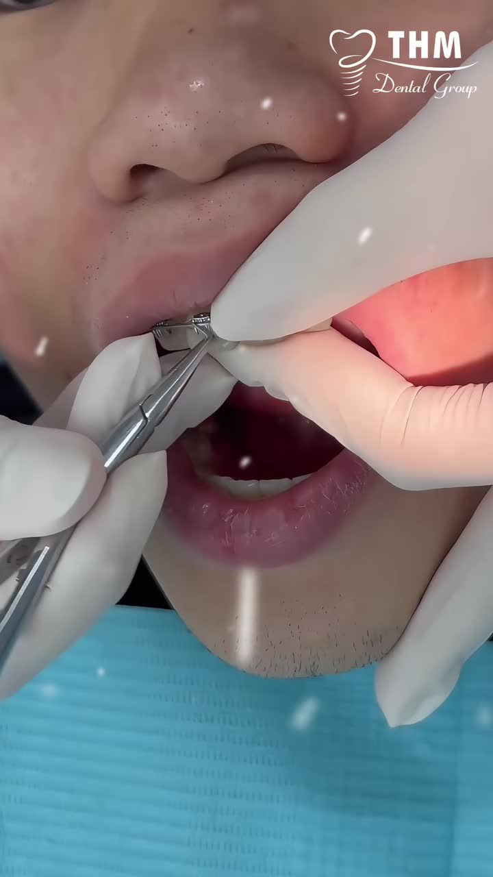 Noel này đừng chỉ trao nhau món quà… hãy trao nhau nụ cười đẹp!