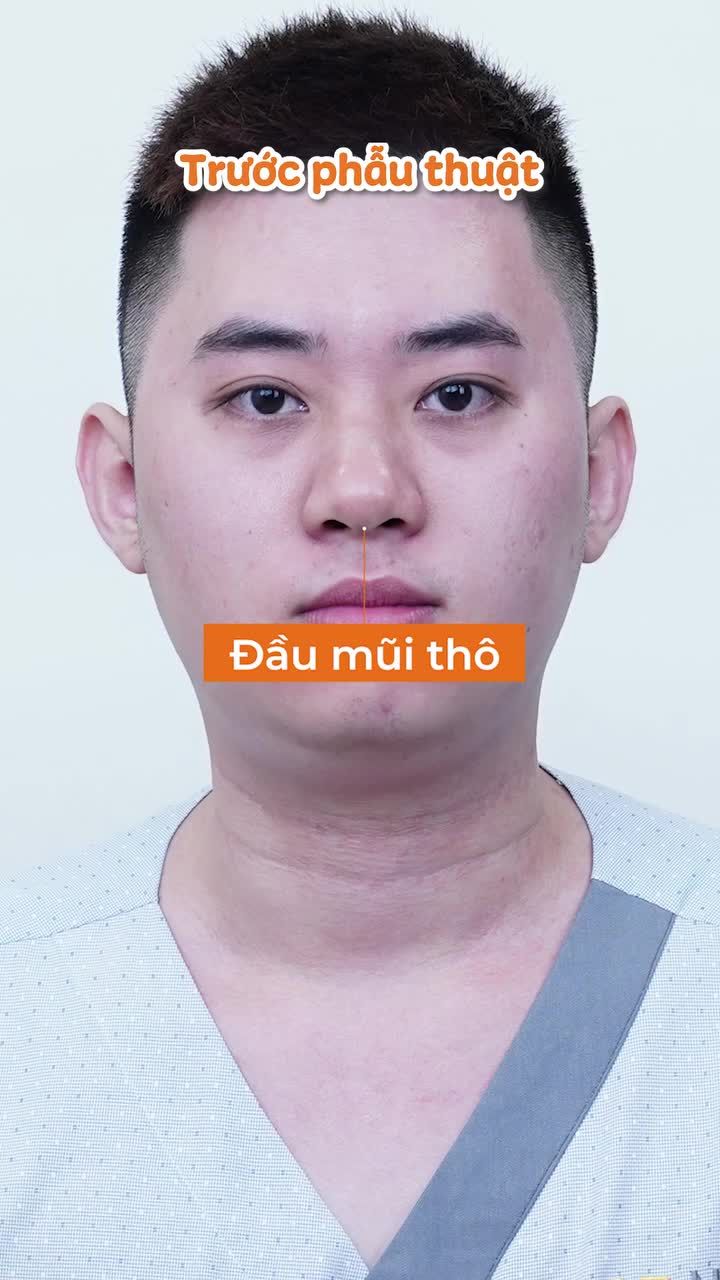 Bạn đã sẵn sàng cải thiện khuyết điểm để tự tin hơn?