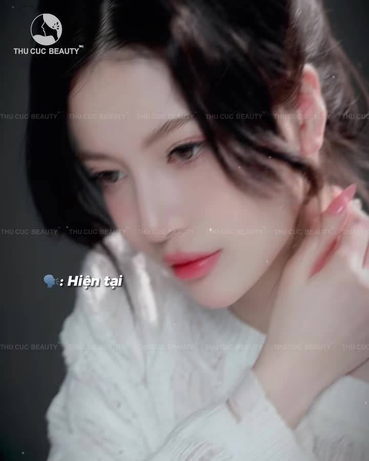 Nâng mũi đẹp tự nhiên. Phù hợp gương mặt