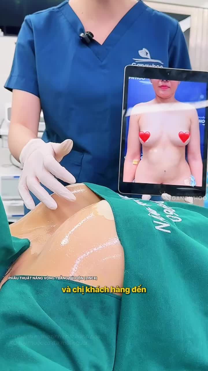 Cận cảnh đôi gò bồng đảo sau 60 phút dưới bàn tay khéo léo của các bác sĩ, kết quả sau nâng căng tròn, tự nhiên, khe LineX quyến rũ