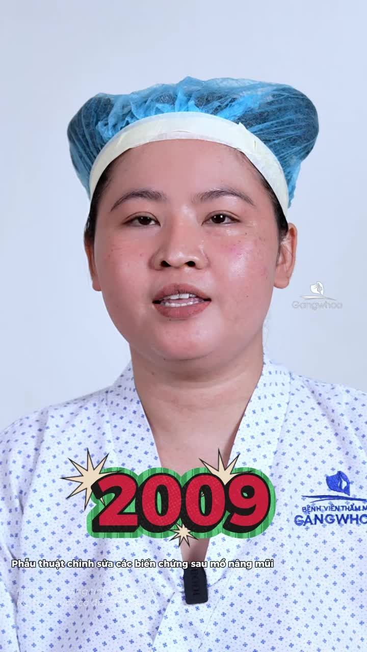 Mũi lắc lư mỗi lần chạm, đã đến lúc cần sửa mũi lại. Phẫu thuật chỉnh sửa các biến chứng sau mổ nâng mũi