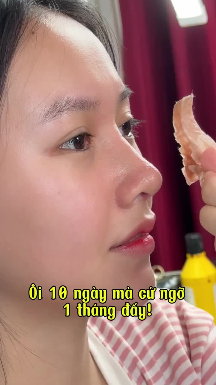 MŨI 10 NGÀY ĐẸP XUẤT SẮC - TỰ NHIÊN HỢP MẶT - XINH ĐẸP THANH TÚ!!