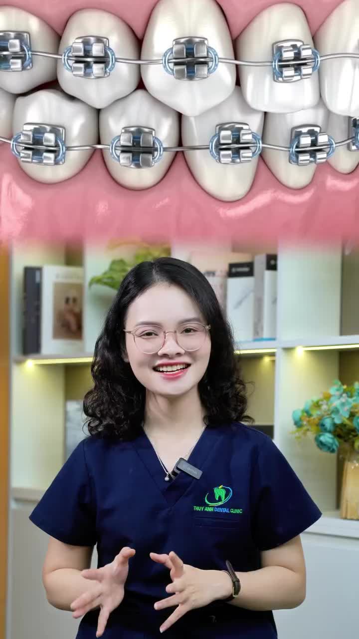 BẠN CÓ ĐANG PHÙ HỢP ĐỂ NIỀNG RĂNG?