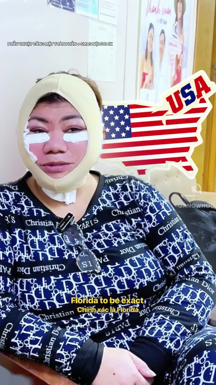Y tá người Mỹ đánh giá thế nào sau khi phẫu thuật căng da mặt toàn phần + Smas nội soi 4K?