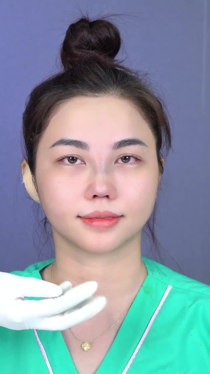 NÂNG MŨI CẤU TRÚC - DÁNG THIẾT KẾ ĐẸP THEO NÉT RIÊNG!