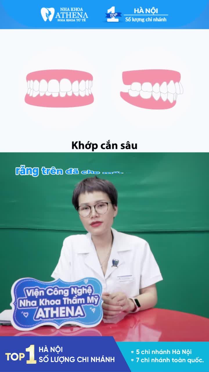 Bị khớp cắn sâu là cảm giác thế nào?