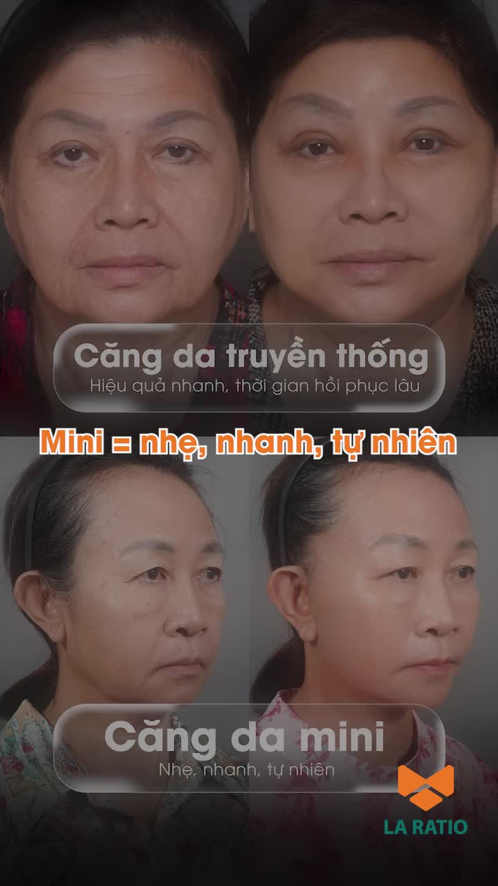 Mini = nhẹ, nhanh, tự nhiên.