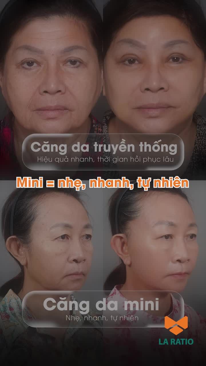 Mini = nhẹ, nhanh, tự nhiên.