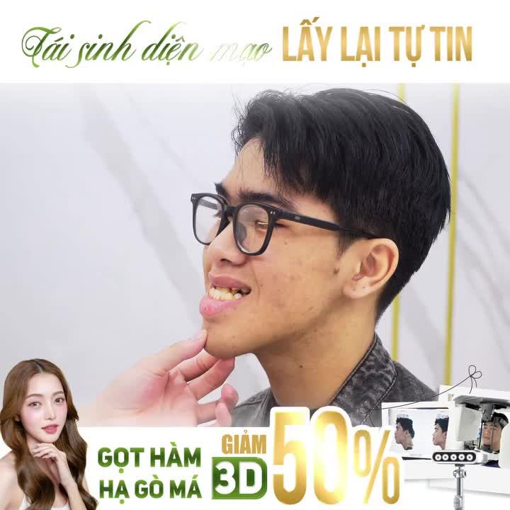 TRẢI NGHIỆM FACE SCAN 3D ĐỈNH CAO, TẬN HƯỞNG ƯU ĐÃI 50%