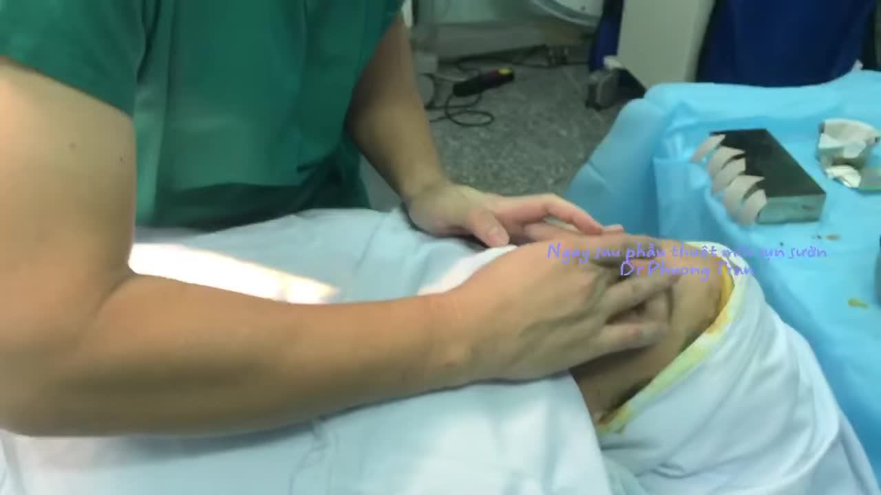 Băng keo cố định nẹp mũi có độ bám dính rất cao, vì vậy để đặt nẹp đúng vị trí và chính xác, bác sĩ cần thao tác trực tiếp bằng tay trần, không mang găng.