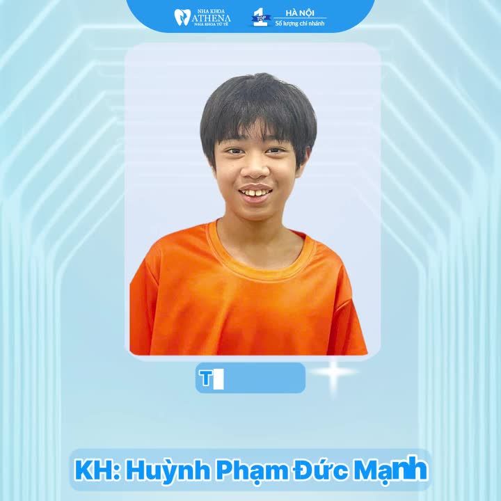 CHÀO 2026 - TOP 3 CA NIỀNG RĂNG "ĐỔI ĐỜI" ĐÓN NĂM MỚI TẠI ATHENA!