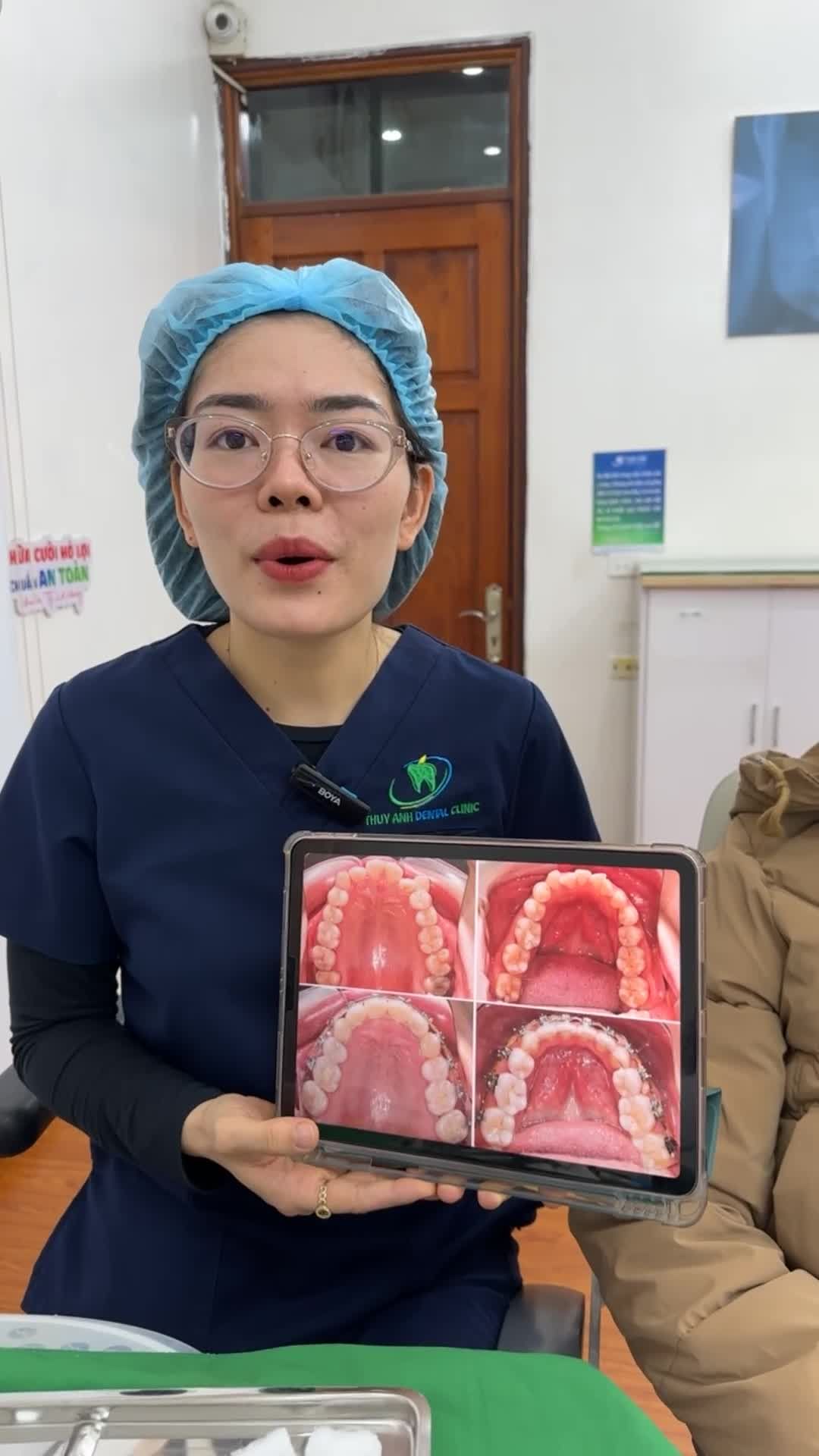 Phân tích quá trình chỉnh nha và tháo mắc cài cho chị Hiên 37 tuổi khách hàng tại Nha Khoa Thuỳ Anh