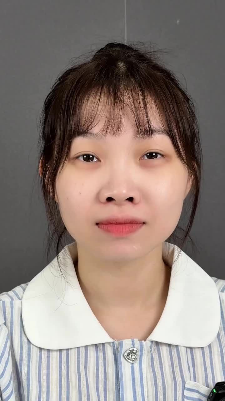 Sau nâng mũi - Sở hữu ngay cô vợ siêu xinh đẹp, dễ thương => Anh chồng kiểu " Biết thế cho bả đi làm đẹp sớm hơn rùi..."