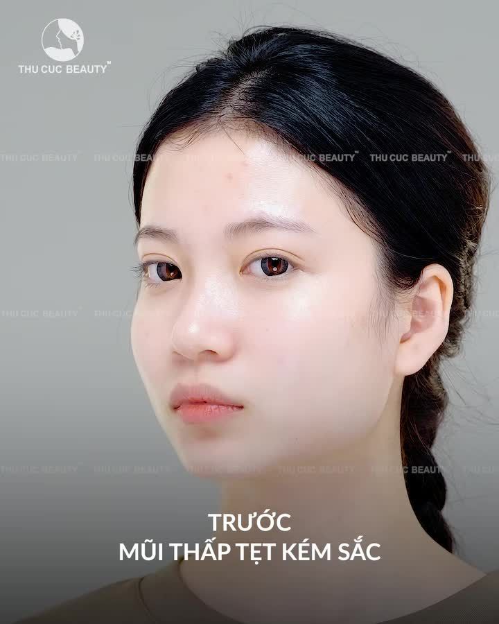 Chọn Mũi TC bye thấp tẹt Thăng hạng nhan sắc