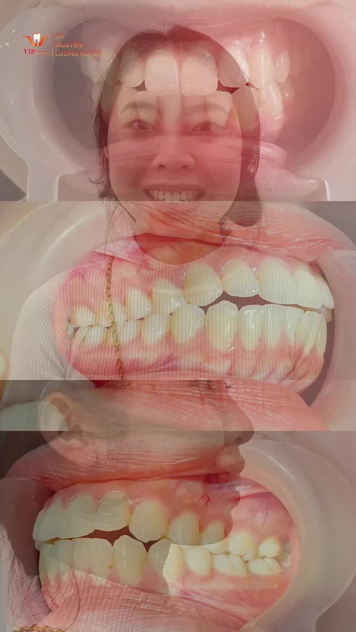 2 Năm kiên trì đổi lại nụ cười tự tin, rạng rỡ