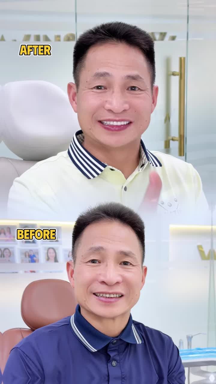 BỊ VỢ "DỤ DỖ" CÙNG LÀM RĂNG VÀ CÁI KẾT "KHÔNG CÓ GÌ ĐỂ CHÊ"