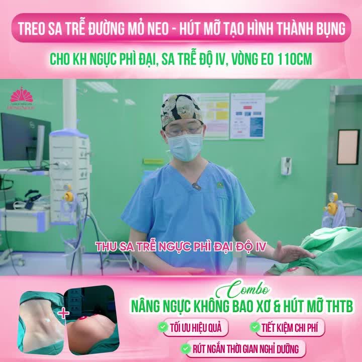 Treo sa trễ đường mỏ neo - Hút mỡ tạo hình thành bụng cho KH ngực phì đại, sa trễ độ IV, vòng eo 110cm