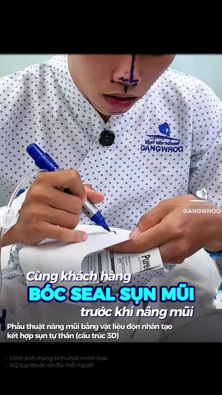 Thủ tục trước khi nâng mũi của khách hàng nhà Gangwhoo