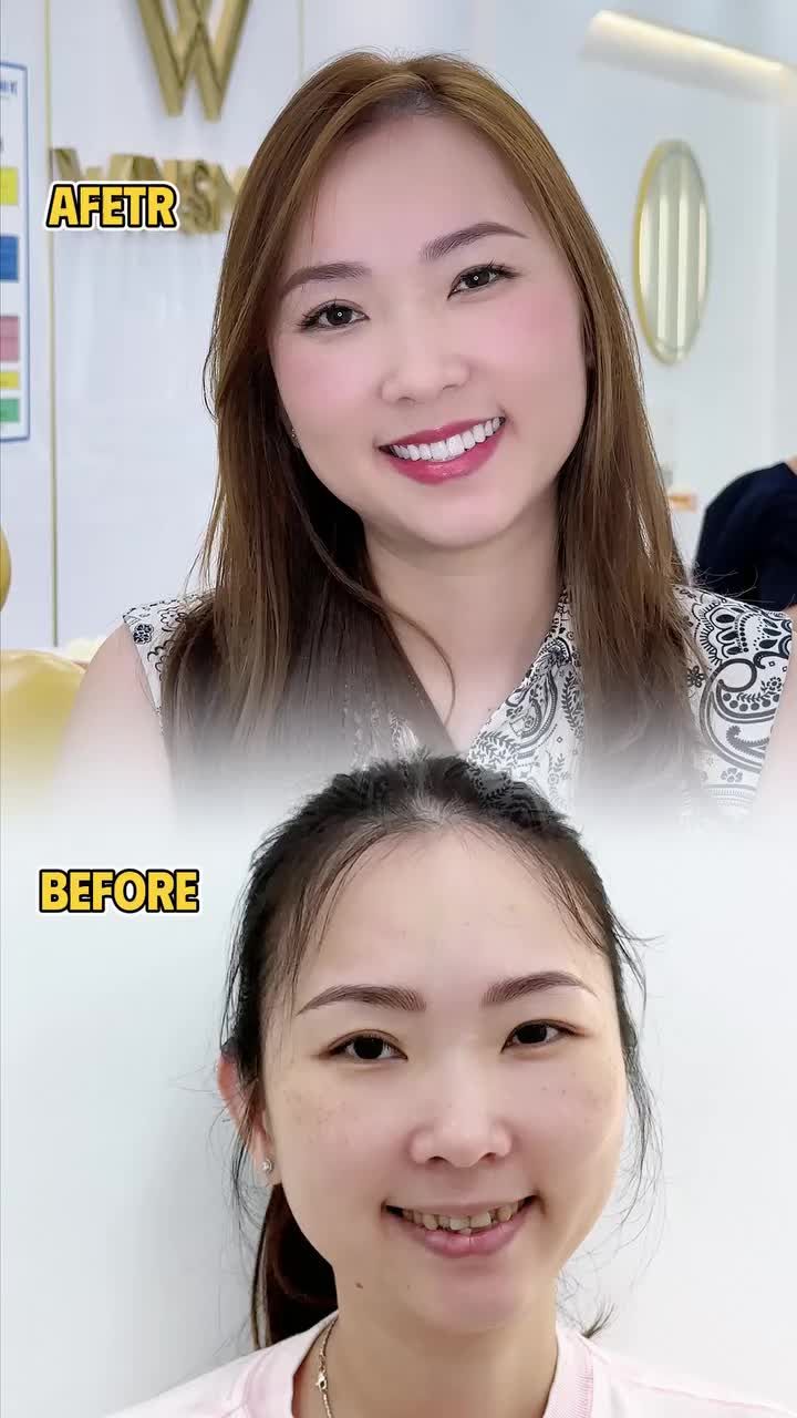 Với chị Tuyết Anh, quyết định phá bỏ giới hạn và rũ bỏ phiên bản cũ chính là bước ngoặt lớn trong hành trình yêu thương bản thân.