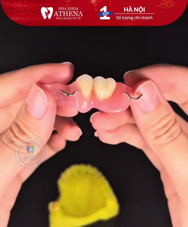 Chỉ còn đúng 24 ngày nữa là đến Tết Nguyên Đán. Nếu chẳng may bị mất 1-2 răng ngay lúc này, chắc chắn bạn đang rất lo lắng: "Liệu có kịp làm răng để ăn Tết không?"