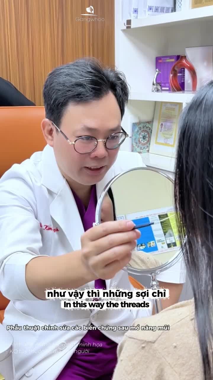 Giải pháp nào cho chiếc mũi co rút, lồi lõm vì nâng chỉ? Phẫu thuật chỉnh sửa các biến chứng sau mổ nâng mũi