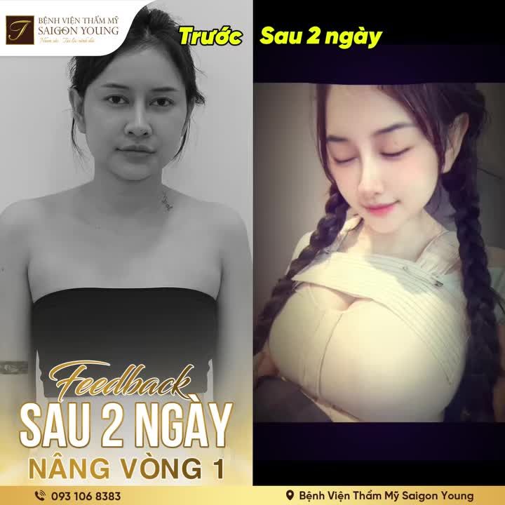 Tin được không!!! Đây là sau 2 ngày nâng vòng 1 tại Saigon Young