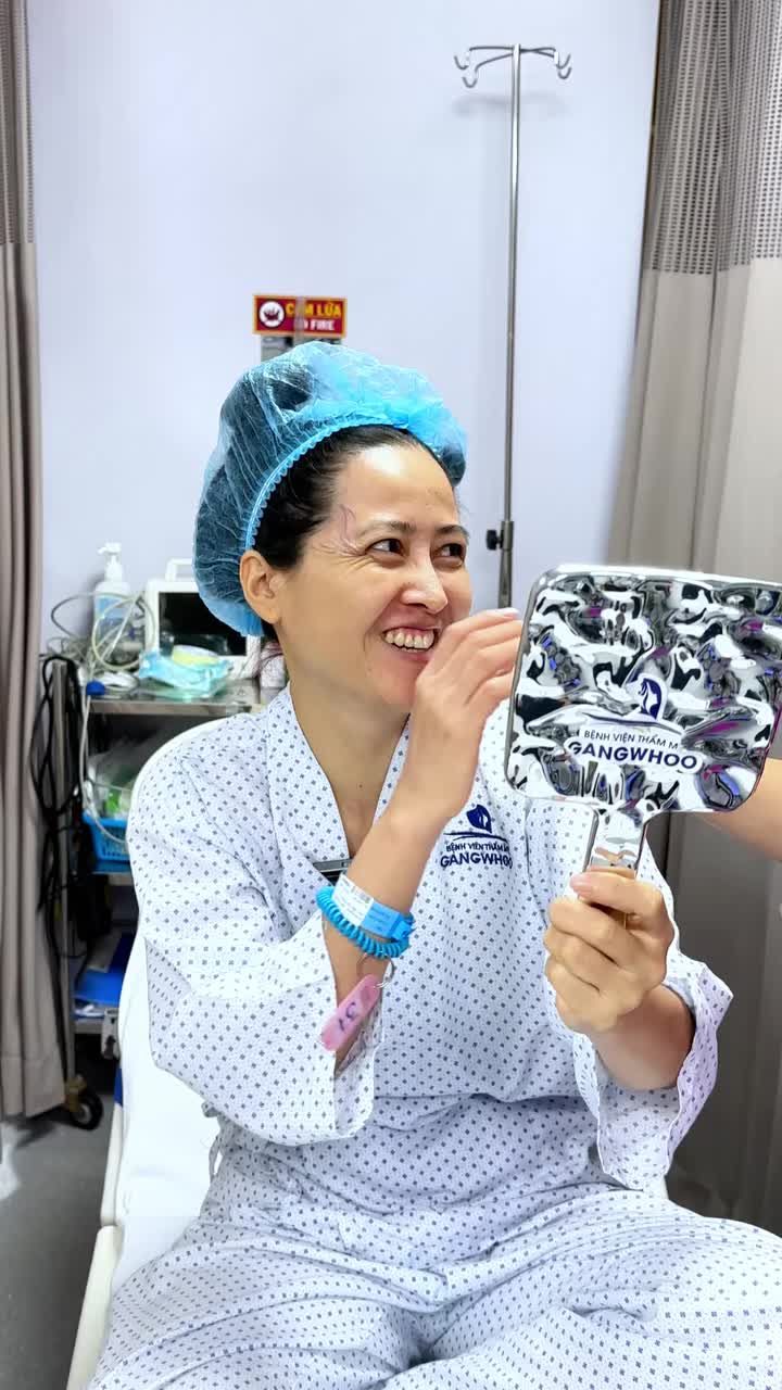 ÁC SĨ PHÂN TÍCH TRƯỚC PHẪU THUẬT – GIẢI PHÁP ĐỘN THÁI DƯƠNG XÓA BỎ GƯƠNG MẶT KHẮC KHỔ