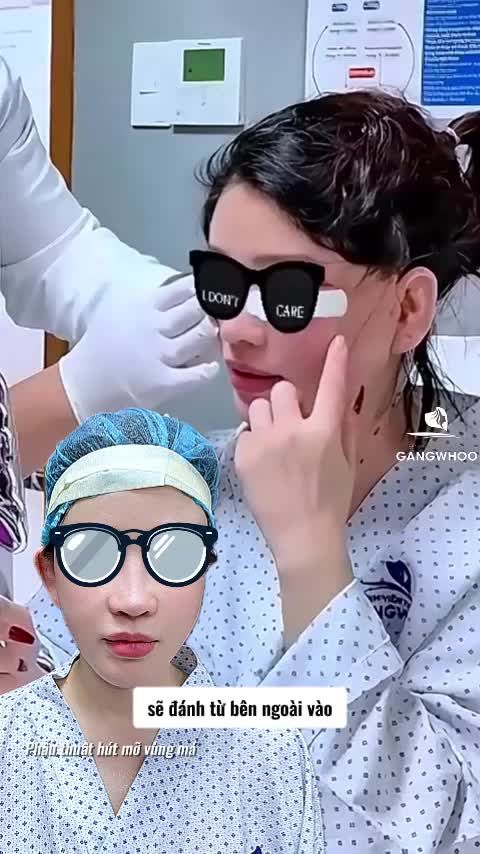 Bác sĩ thăm khám hậu phẫu cho một ca vừa thực hiện combo: Hút mỡ mặt Ultrasound siết cơ nâng khóe miệng.