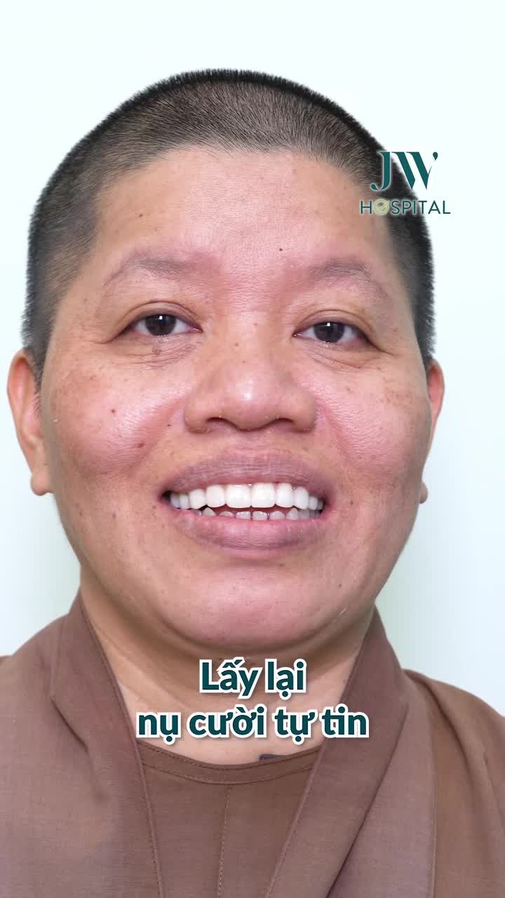 TAI NẠN CƯỚP ĐI NỤ CƯỜI, SƯ CÔ AN GIANG QUYẾT TÂM ĐẾN JW BỌC 11 RĂNG SỨ LẤY LẠI DIỆN MẠO TỰ TIN