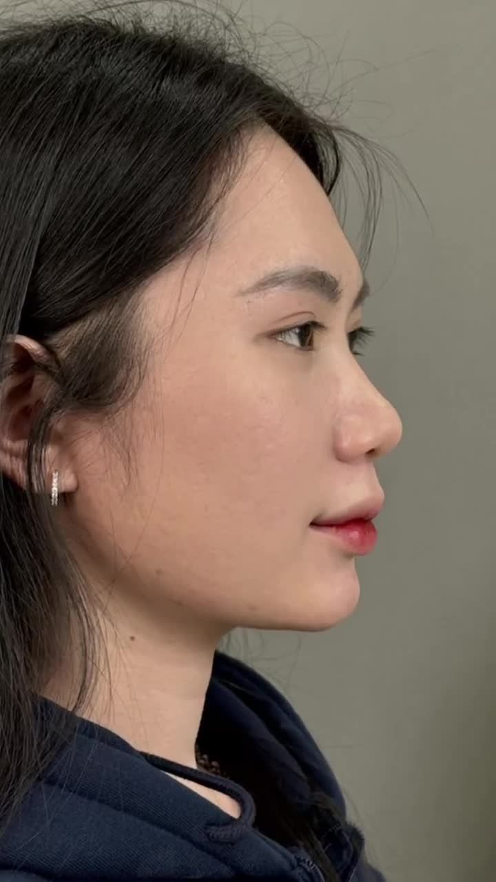 THAY DÁNG MŨI - ĐỔI VẬN TÌNH DUYÊN