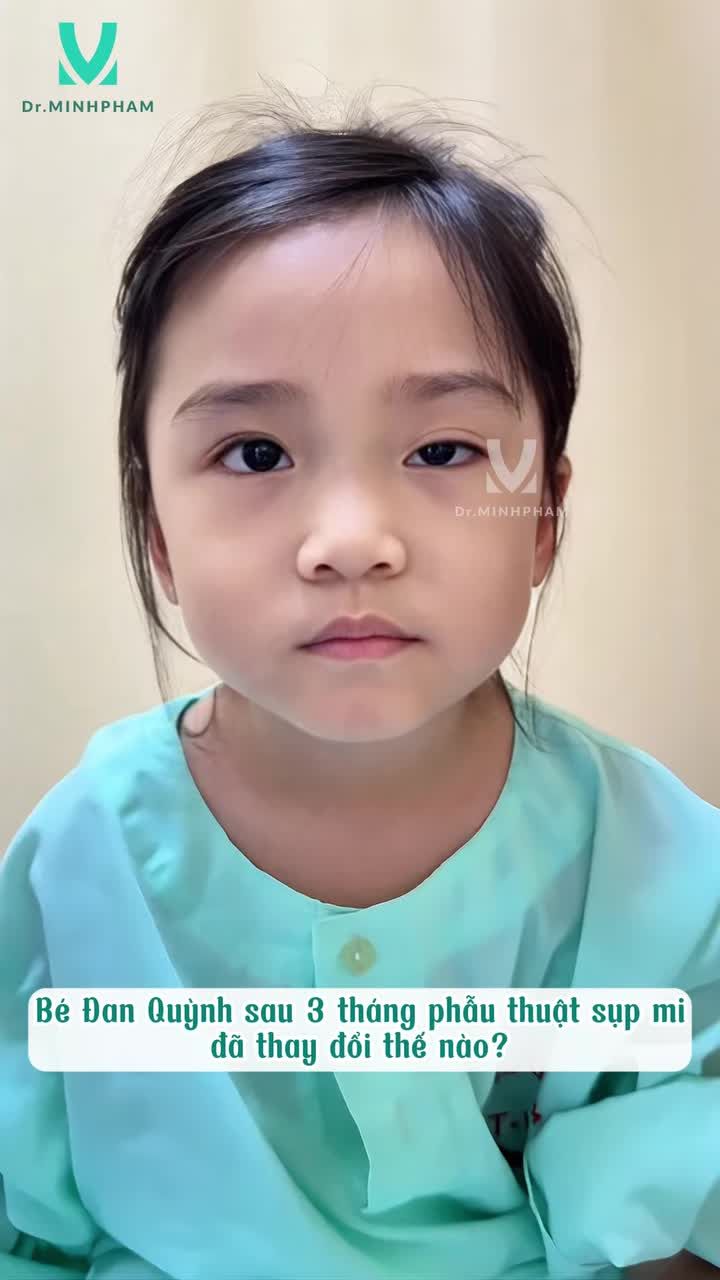 Bé Đan Quỳnh sau 3 tháng phẫu thuật sụp mi đã thay đổi thế nào?