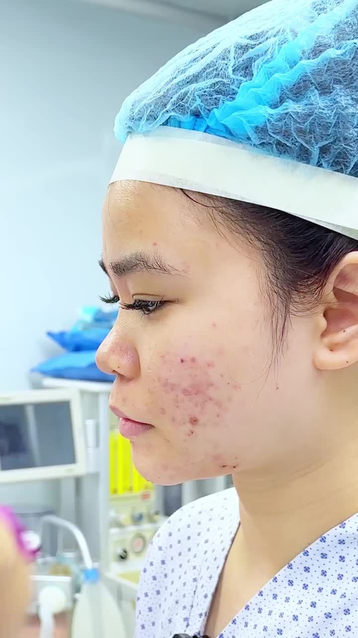 TẠI SAO PHẢI PHÂN TÍCH TỶ LỆ MẶT TRƯỚC KHI NÂNG MŨI?