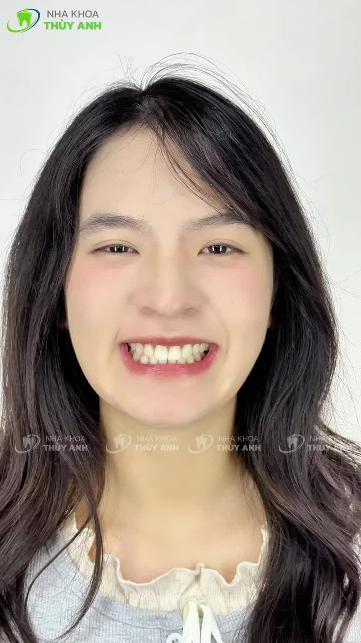 NÂNG CẤP NỤ CƯỜI – BẬT MOOD ĐÓN TẾT