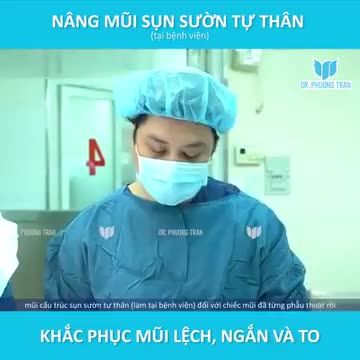ĐÃ TỪNG SỬA MŨI 2 LẦN, DÁNG MŨI LỆCH – GÃY – NGẮN SẼ THAY ĐỔI RA SAO SAU NÂNG MŨI BẰNG SỤN SƯỜN TỰ THÂN?