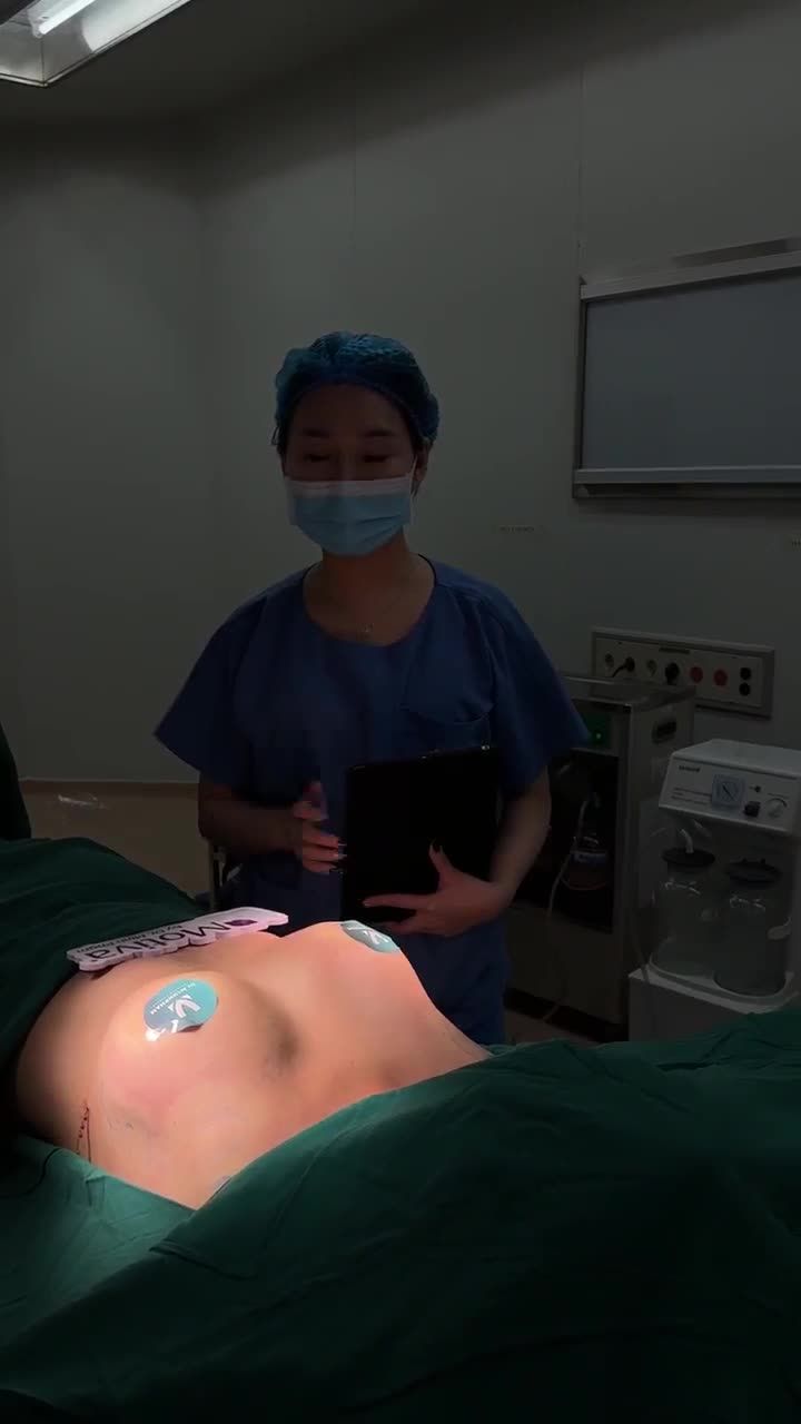 Kết quả ca nâng cấp V1 bị lệch mô tuyến