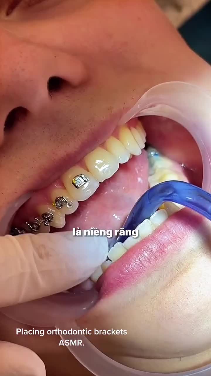 Cứu tinh cho những ca móm nặng đây rồi! Nhìn thì lạ nhưng hiệu quả "thần thánh" thì không thể phủ nhận.