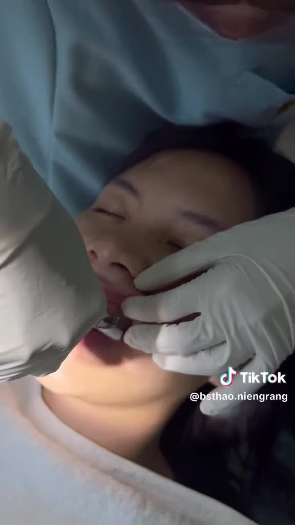 Tháo niềng đón tết gì chưa người đẹp ?