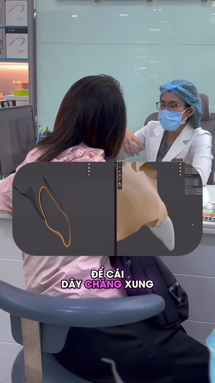 Niềng răng cho trẻ – Đừng đợi đến khi quá muộn!
