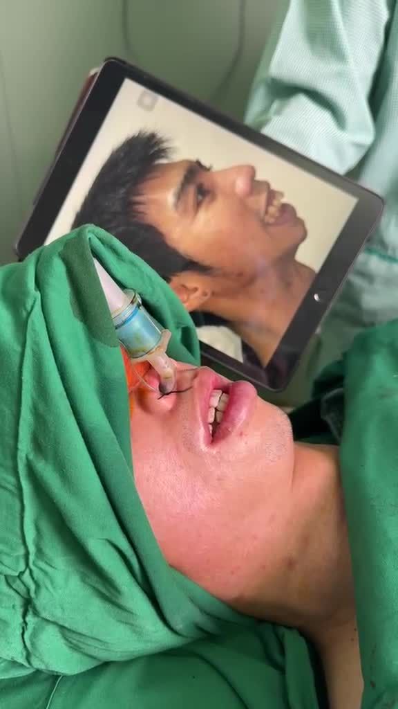 CẬN CẢNH: Chàng trai 9X sở hữu gương mặt chuẩn soái ca Hàn ngay trên bàn phẫu thuật JW với PHẪU THUẬT HÀM HÔ